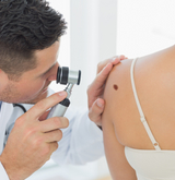 dermatologist examining a woman's mole for Melanoma