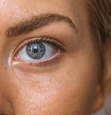 These Risk Factors Increase Your Chances of Having Skin Cancer