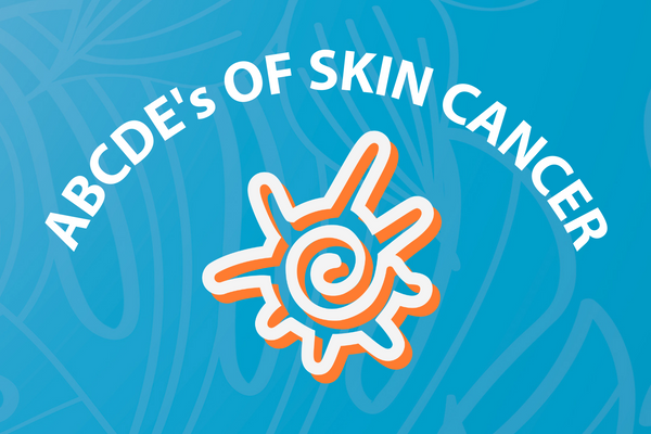 ABCDE's of Skin Cancer