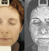 UV exposure and its effect on a woman's face