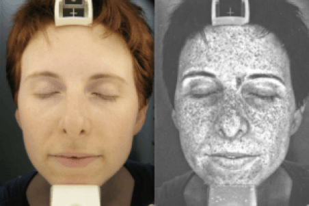 UV exposure and its effect on a woman's face
