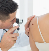 dermatologist looking at a mole
