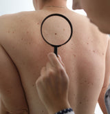 dermatologist performing a skin care check