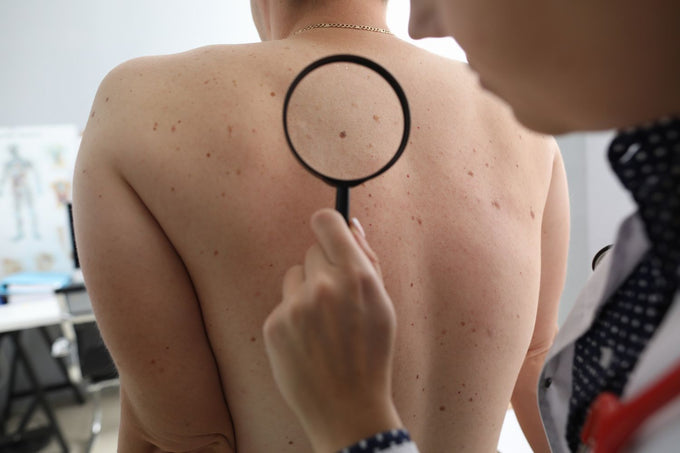 dermatologist performing a skin care check