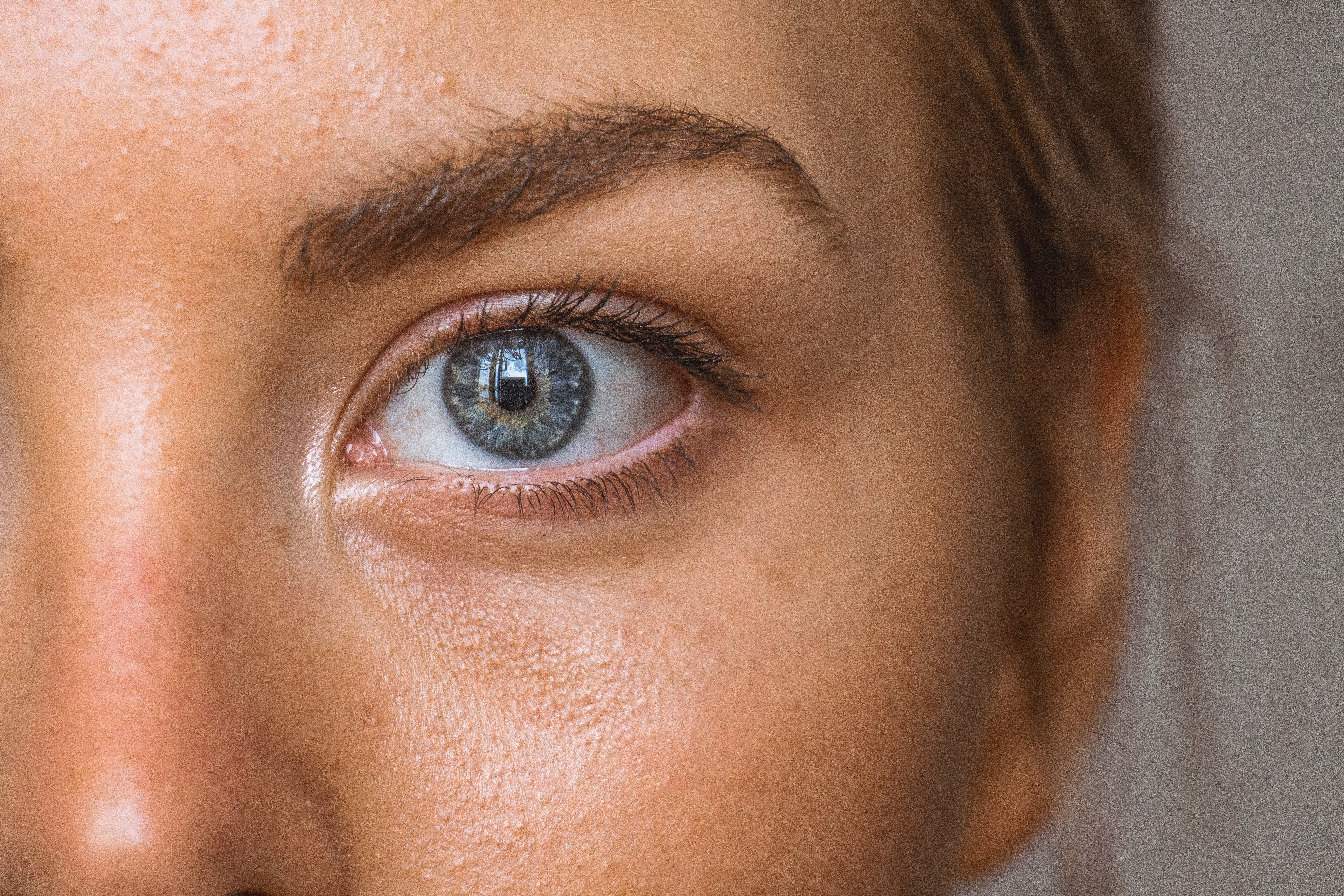 These Risk Factors Increase Your Chances of Having Skin Cancer