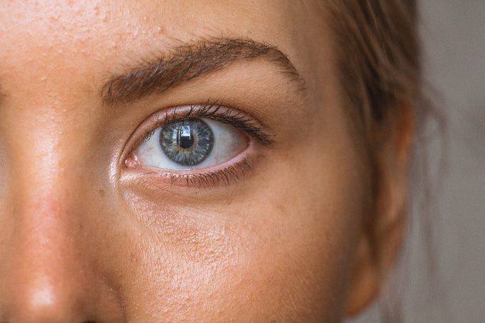 These Risk Factors Increase Your Chances of Having Skin Cancer