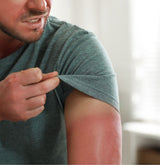 Man with a sunburn