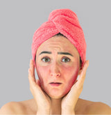 The Science Behind Sunburns