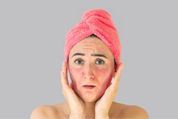 The Science Behind Sunburns