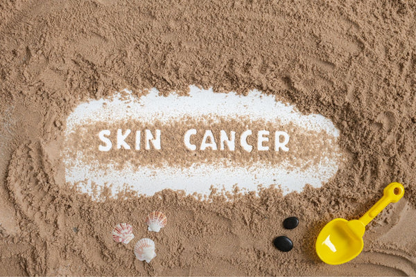 5 Questions About Skin Cancer You Might Be Embarrassed to Ask